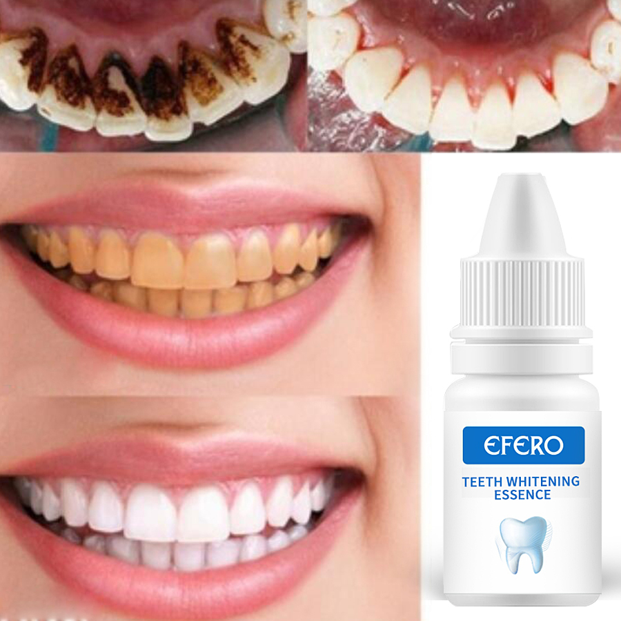 1PCS EFERO Teeth Whitening Serum Oral Hygiene Essence Effective Remove Stain Teeth Cleaning Essence Bleaching Dental Products
