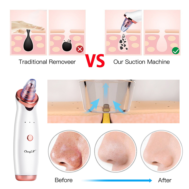 Electric Vacuum Suction Cleaner Face Cleaning Blackhead Remover Black Spot Facial Cleansing Machine Pore Cleanser Acne Removal
