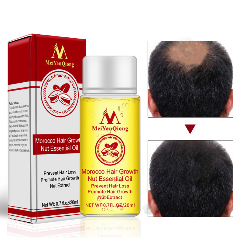 Multi-functional Nut Hair Care Growth Liquid Powerful Hair Growth Essence Hair Loss Product Essential Oil Liquid Treatment TSLM1