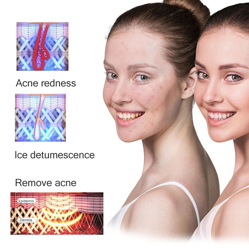 Osenyuan Professional IPL Hair Removal Machine Permanent Laser Rejuvenation Facial Body Electric Pulsed Light Epilator for Women
