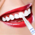 EFERO Dental Teeth Whitening Pen Tooth Cleaning Bleaching Stains Whitening Tooth Essence Oral Care Teeth Whitening Serum Pen