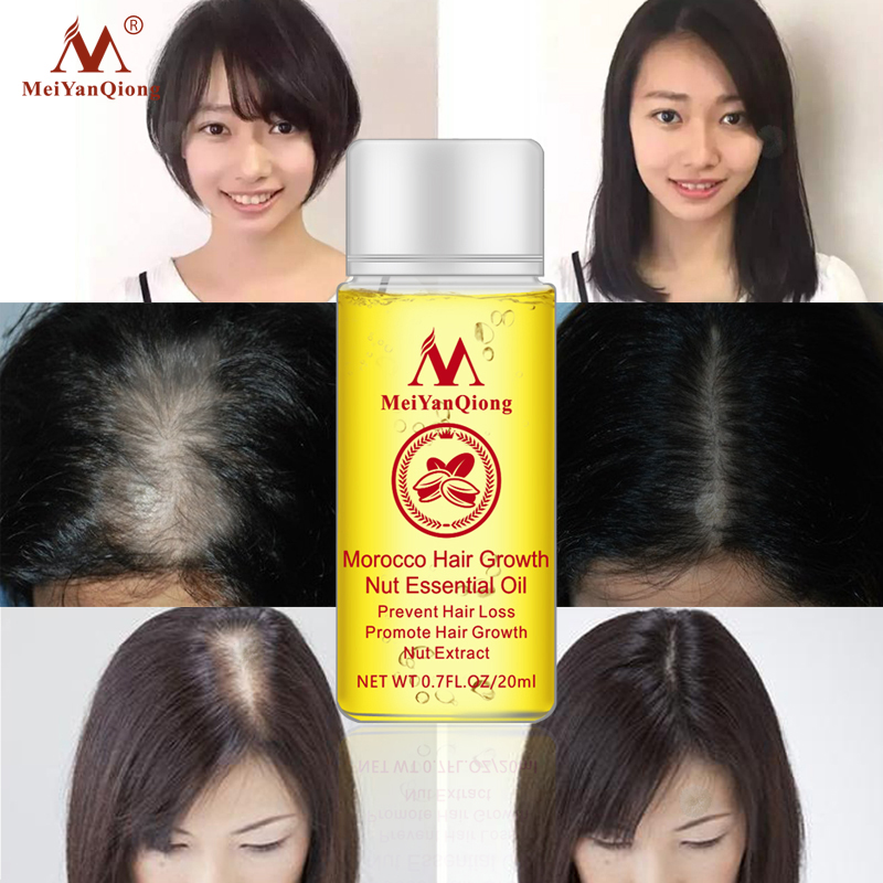 MeiYanQiong 20ML Fast Powerful Hair Growth Essence Hair Loss Products Essential Oil Liquid Treatment Preventing Hair Loss Hair