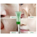 Soothing and Moisturizing Aloe Vera+Face Care Removes Blackhead Mask Oil-Control Facial Cream Acne Treatment Beauty Face Cream