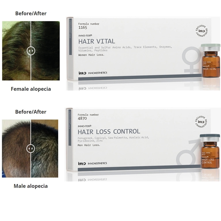 Inno-TDS-Hair-Loss-Promote-The-Growth-of-New-Hair-Loss-Control-Treatment-Male-Pattern-Baldness-or-Androgenic-Alopecia-Improve-Scalp-Health-Reduce.webp