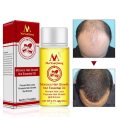 Natural Hair Loss Treatment Andrea Hair Growth Products Ginger Oil Hair Growth Faster Grow Hair Ginger Shampoo Stop