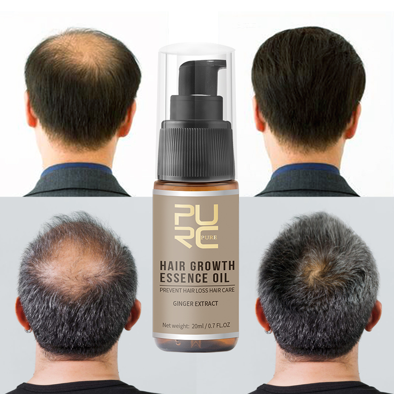 PURC Hot Sale Hair Loss Set Thickening Shampoo & Hair Essence oil & Hair Growth Spray Hair Loss Treatment Help for Hair Growth