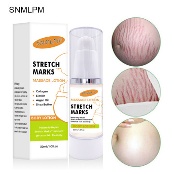 30ml Remove Stretch Marks Cream Anti Wrinkle Anti Aging Maternity Skin Repair Remove Pregnancy Scars Treatment Body Skin Care