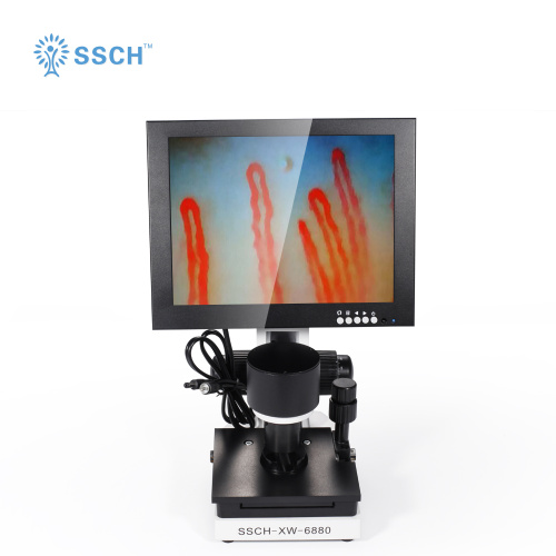 Digital Microscope Terminal Microcirculation Observation for Sale, Digital Microscope Terminal Microcirculation Observation wholesale From China