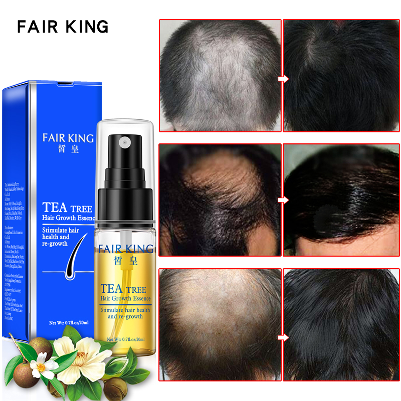 Tea Tree Hair Growth Essence Hair Loss Products Essential Oil Liquid Treatment Preventing Hair Loss Make Hair Smoother Oil 20ml