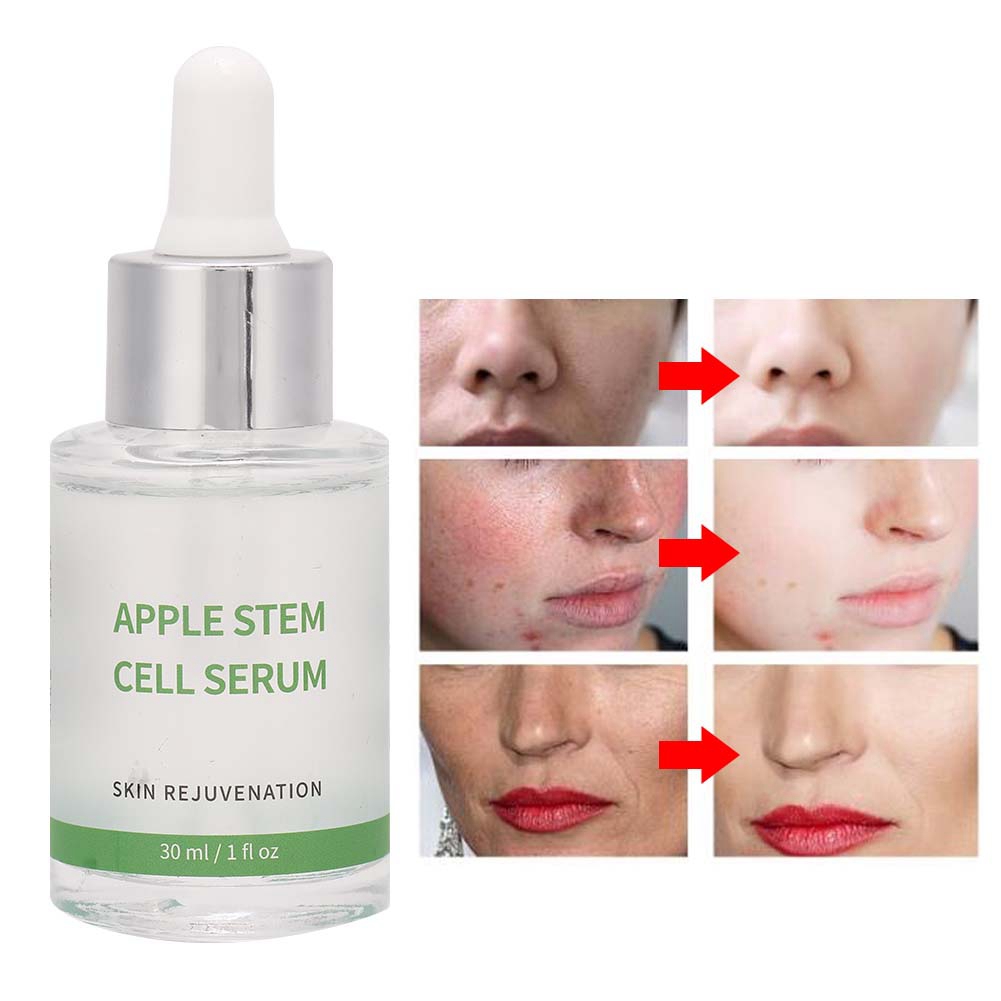 Skin Rejuvenation Tighten Anti Wrinkles Skin Care Essence Serum Face Serum Series Apples Stem Cell Serum