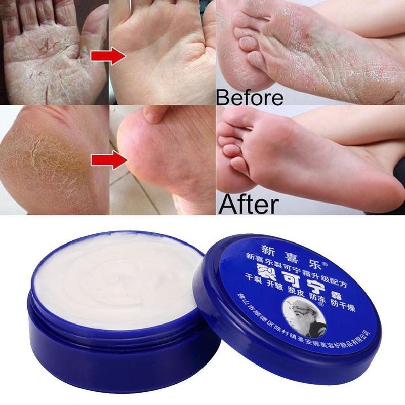 Anti-Drying Heel Cracked Repair Cream Chinese Herbal Hand Cream Herbs Crack Foot Cream Removal Dead Skin Hand Feet Care