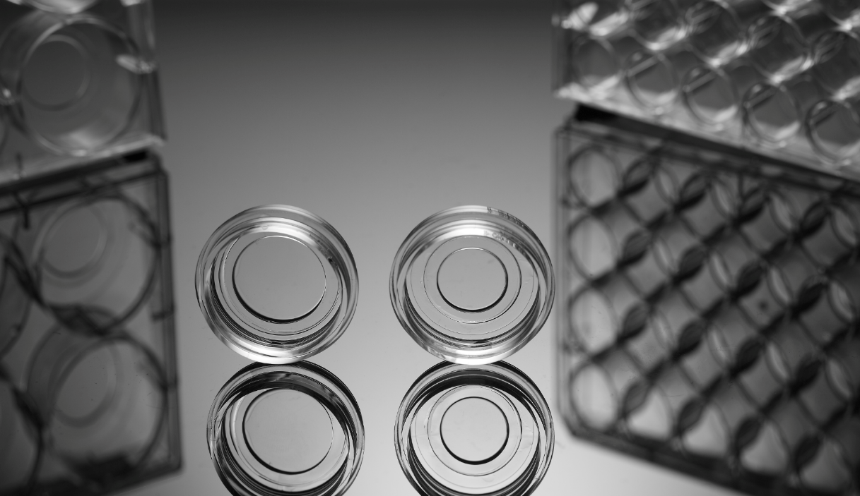 glass bottom cell culture dish