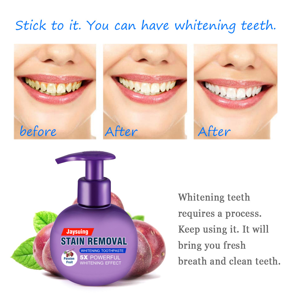 Stain Removal Whitening Toothpaste Fight Bleeding Gums Toothpaste Tooth Cleaning, Oral Care Whitening Press Type Tooth Paste 810