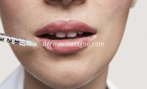 lip injection