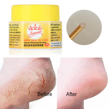 Anti Fungal Hand Foot Heel Anti-Drying Crack Repair Banana Oil Massage Cream Nourish Gentle Skin Care Anti Chapped Peeling Dead