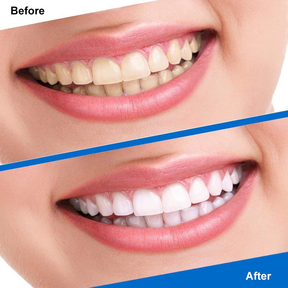 7/14 Pairs Teeth Whitening Strips Oral 3D Teeth Whitening Strips Stain Removal Tooth Bleaching Whitening Repairing Teeth Care