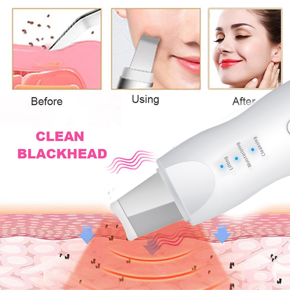 Blackhead Remover Vacuum Electric Deep Facial Cleansing Ance Remover Pimple Black Head Suction Skin Scrubber Vacuum Pore Cleaner