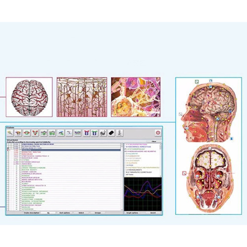 oberon biofeedback NLS oftware metatron diagnostic machine for Sale, oberon biofeedback NLS oftware metatron diagnostic machine wholesale From China