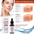 Tca Aid Skin Peel Face Serum Trichloroaectic Acid 20% Skin Peel Pore Minizing Wrinkles Spots Skin Care Face Serum 30ml