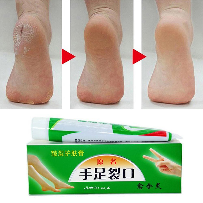 Hand Foot Crack Cream Heel Chapped Peeling Repair Anti Dry Crack Winter Feet Care Ointment SMJGood