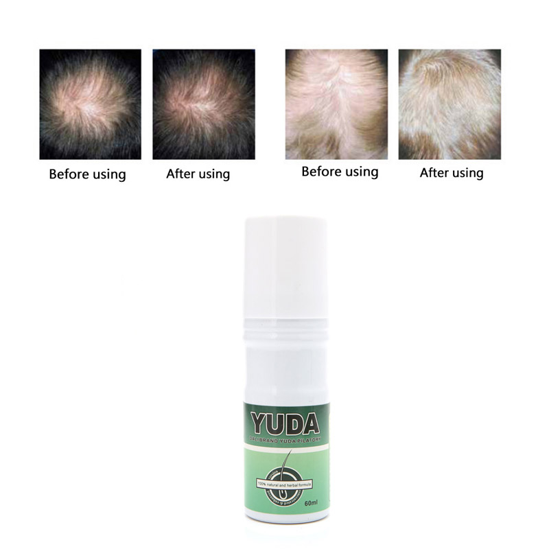 Yuda Pilatory Hair Regrowth Liquid Product Anti Alopecia Treatment Baldness 60ML 896D