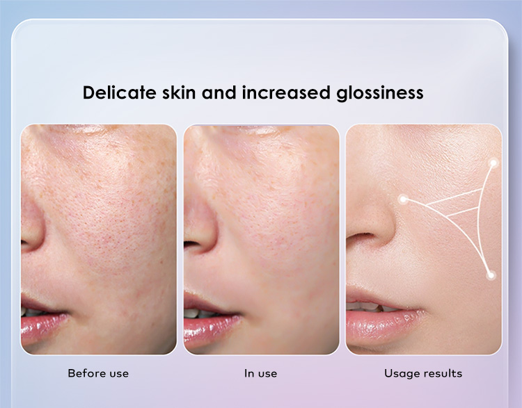 red light therapy for wrinkles