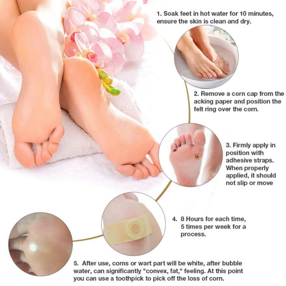 6pcs Medical Plaster Foot Corn Removal Remover Warts Thorn Patch For Foot Calluses atches Corn of eet Care