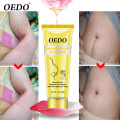 OEDO Rose Remove Stretch Mark Cream Nourish Moisturizing Anti-wrinkle Pregnant Women Skin Repair Remove Obesity Tattoo Body Care