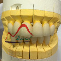 Zirconia Crown Withstanding Biting Pressure