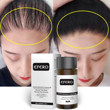 EFERO Fast Powerful Hair Growth Essence Hair Loss Products Essential Oil Treatment Preventing Baldness Hair Loss Hair Care 20ml