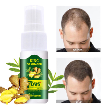 Ginger Hair Growth Essence Spray 7 Days Anti Hair Loss Germinal Hair Growth Serum Hair Regrowth Essential Oil for Men Women 30ml