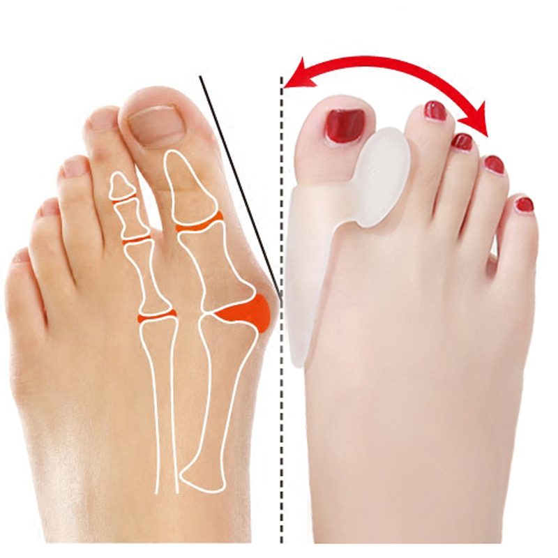 2Pair Foot Separator For Toes Orthopedic Hallux Valgus Correction Pedicure Silicone Finger Splint Toe Bone Thumb Posture Correct