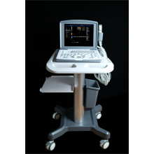 Portable Color Doppler Ultrasound Machine for Cardiac
