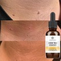 Skin Tags Warts Removal Essence Liquid Papillomas Removal Against Foot Corn Marker Wart Moles Genital Treatment Care Oil 10/30ml