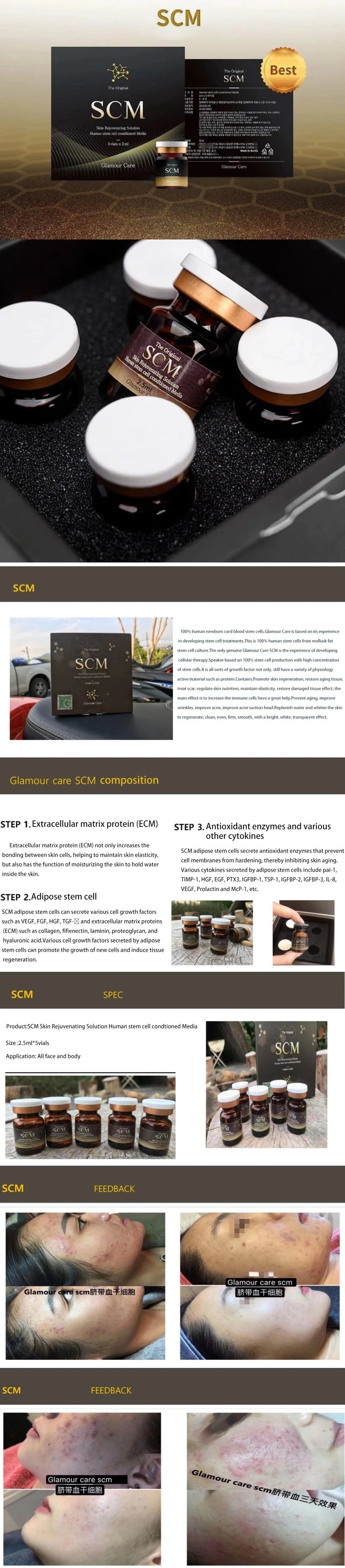 High-Quality-Scm-Skin-Rejuvenating-Solution-Injectable-Dermal-Fillers-Stimulate-Collagen-Skin-Whitening-2-5ml-5vials-Injection.webp