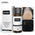 Hair Care Hair Growth Essential Oils Essence Anti Preventing Hair Loss Products Beauty Dense Fast Original Hair Growth Serum