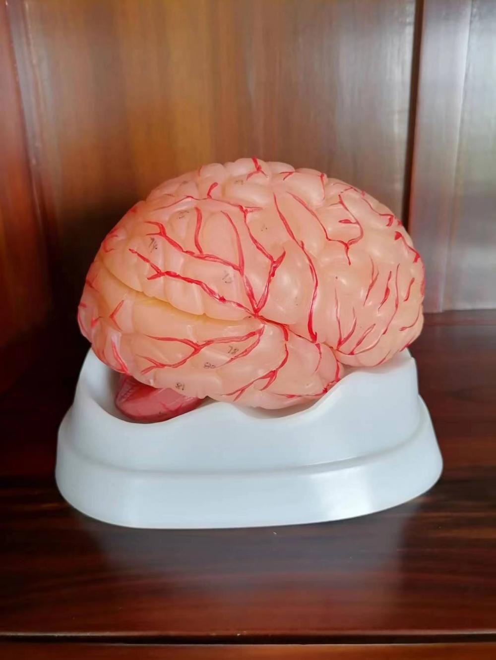 Brain with Artery and Nerves