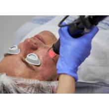 Choicy Academy Acne Treatment Online Training