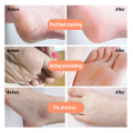 20g Soften Heel Cracked Repair Cream Dead Skin Crack Treatment Anti-Drying Hand Feet Care Moisturizing Removal Banana Oil TSLM2