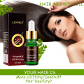 10ml Powerful Hair Growth Essence Products Conditioner Oil Treatment Preventing Hair Loss Hair Care Repairing Regenerating Serum