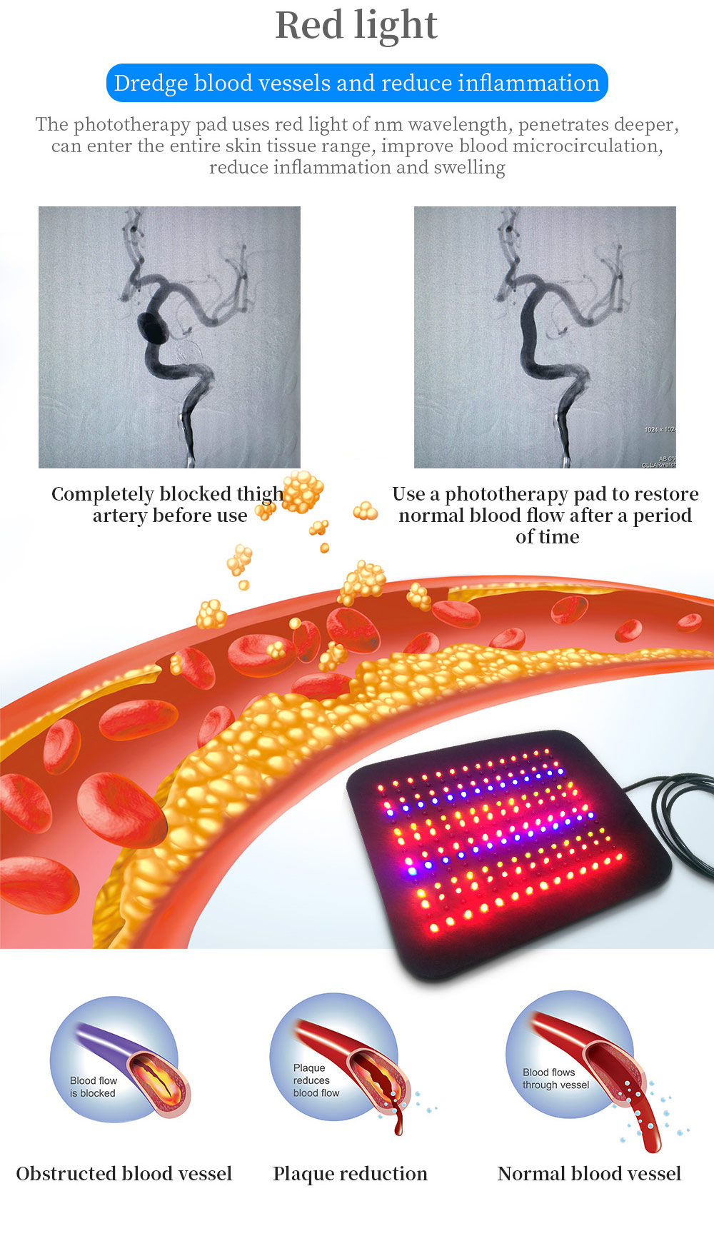 light therapy pads