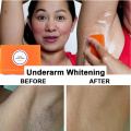 Dark Black Skin Lightening Soap Kojic Acid Whitening Soap Kojic Acid Glycerin Brighten Face Body Skin Bleaching Soap