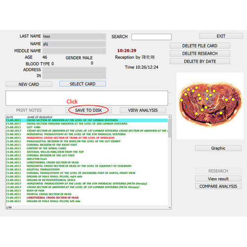 bioresonance 8d nls health analyzer scanning equipment for Sale, bioresonance 8d nls health analyzer scanning equipment wholesale From China