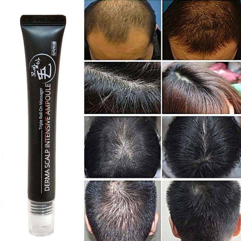 Hair Line Growth Serum Derma Scalp Intensive Ampoule Triple Roll Massager Fast Hair Regrow Hair Loss Essence Prevent Hair Loss