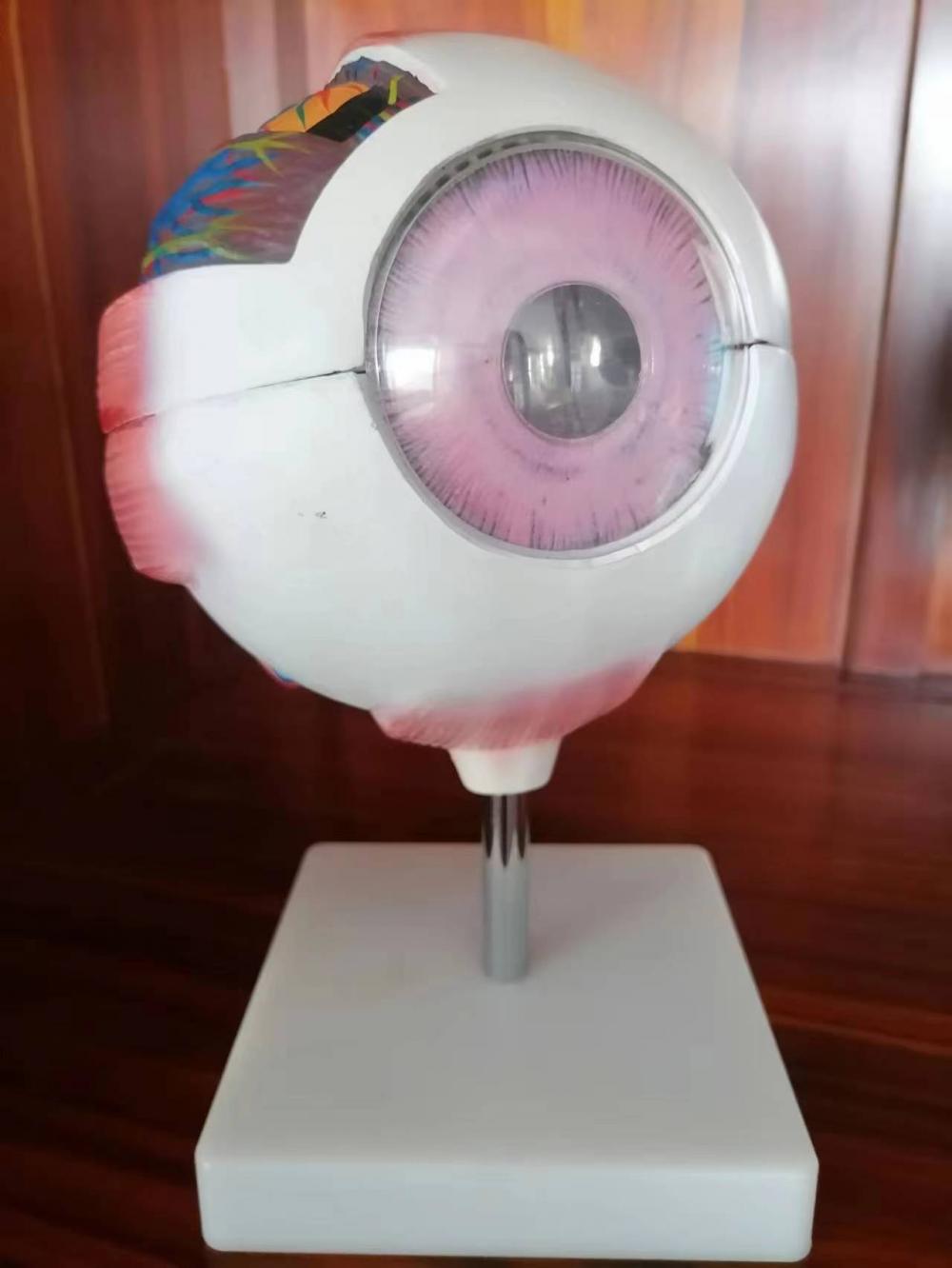 Enlarged Eyeball Anatomy Model