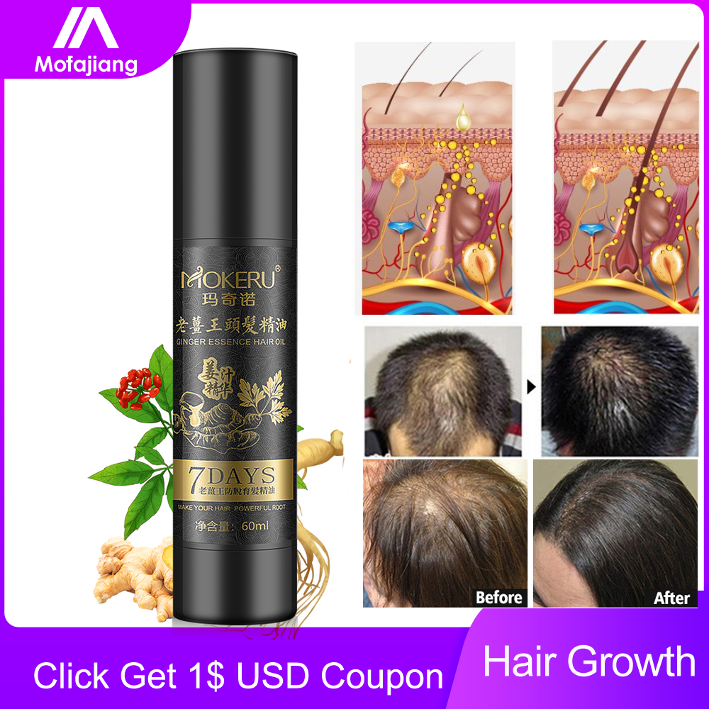 Hair Growth Essence Oil Serum Effective Anti Loss Ginseng Ginger Extract Nourish Roots Treatment Damaged Repair Care Products