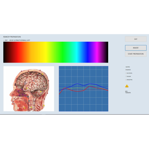 bioresonance aura analyzer diagnostic machine for Sale, bioresonance aura analyzer diagnostic machine wholesale From China