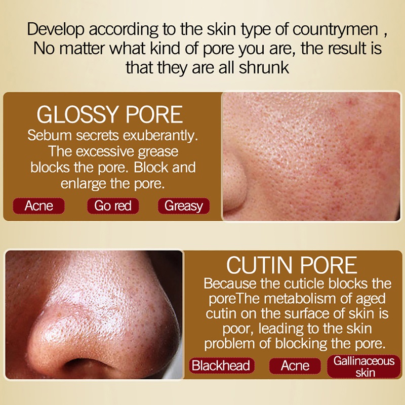 Shrink Pores Face Serum Acne Treatment Essence Blackhead Remover Oil-control Whitening Serum Moisturizing lighten Skin Care