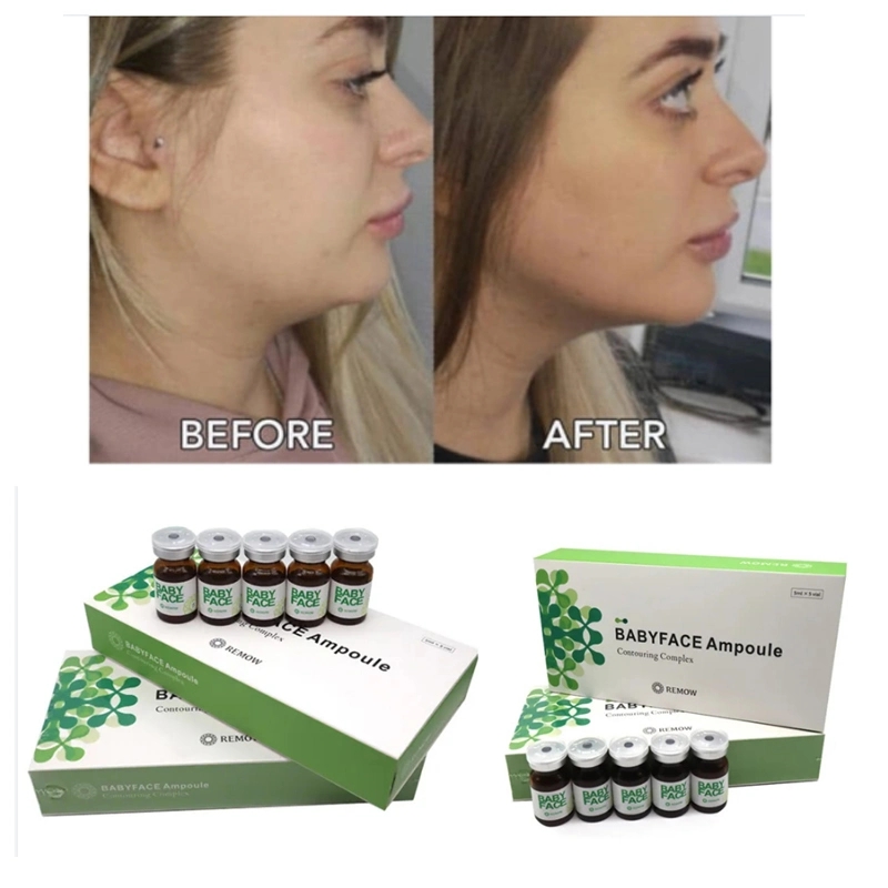 Korea-Remow-Babyface-Contouring-Complex-5ml-Ampoule-Body-Slimming-Fat-Loss-Lipolytic-Solution-for-Face-Contour.webp (2)