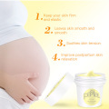 Stretch Marks Body Cream Care Maternity Stretch Marks Remover Thailand Postpartum Obesity Pregnancy Scar Removal Tight Skin Care